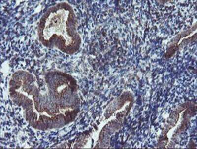 Immunohistochemistry: DPH2 Antibody (OTI4E7) - Azide and BSA Free [NBP2-70585]