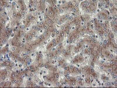 Immunohistochemistry: DPH2 Antibody (OTI4E7) - Azide and BSA Free [NBP2-70585]