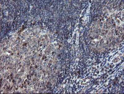 Immunohistochemistry: DPH2 Antibody (OTI4E7) - Azide and BSA Free [NBP2-70585]