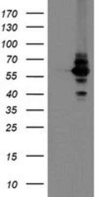 Western Blot: DPH2 Antibody (OTI4E7)Azide and BSA Free [NBP2-70585]