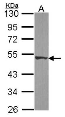 Western Blot: DPH2 Antibody [NBP2-16218]