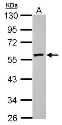 Western Blot: DPH2 Antibody [NBP2-16219]