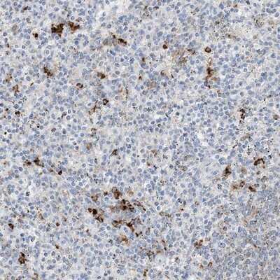 Immunohistochemistry-Paraffin: DPH3 Antibody [NBP1-84276]