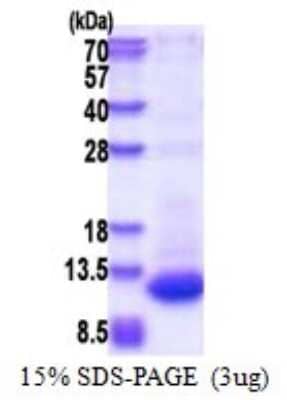 SDS-PAGE: Recombinant Human DPH3P1 His Protein [NBP2-51633]