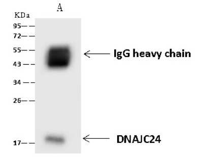 Immunoprecipitation: DPH4 Antibody [NBP2-97599]