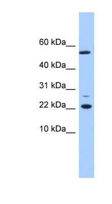 Western Blot: DPH4 Antibody [NBP1-56748]