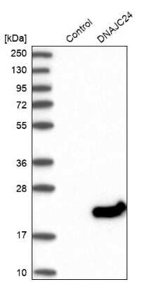 Western Blot: DPH4 Antibody [NBP1-87968]