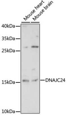 Western Blot: DPH4 AntibodyAzide and BSA Free [NBP2-92116]