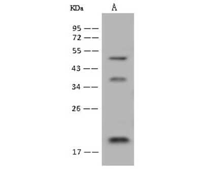 Western Blot: DPH4 Antibody [NBP2-97599]