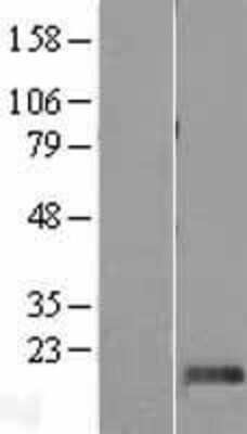 Western Blot: DPH4 Overexpression Lysate [NBL1-09952]