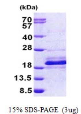 SDS-PAGE: Recombinant Human DPH4 His Protein [NBP2-23007]