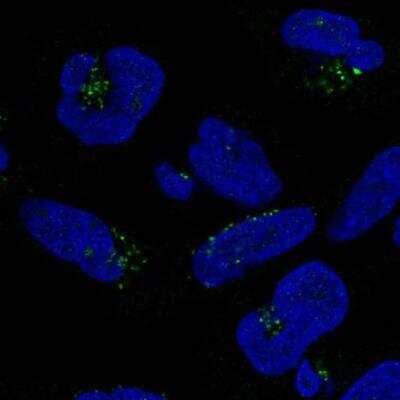 Immunocytochemistry/ Immunofluorescence: DPH5 Antibody [NBP2-76567]