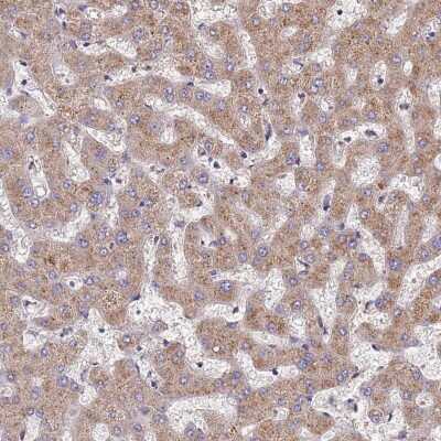 Immunohistochemistry-Paraffin: DPH5 Antibody [NBP2-13934]