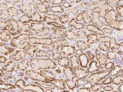 Immunohistochemistry-Paraffin: DPH5 Antibody [NBP2-97162]