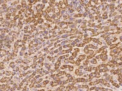 Immunohistochemistry-Paraffin: DPH5 Antibody [NBP2-97162]