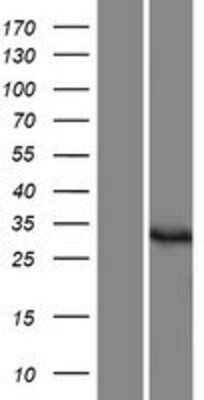 Western Blot: DPH5 Overexpression Lysate [NBP2-07112]