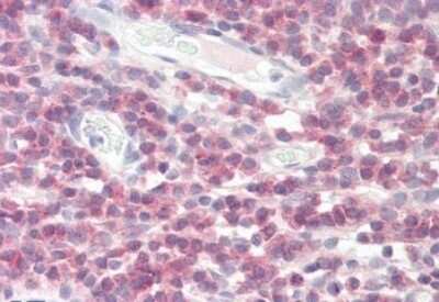 Immunohistochemistry-Paraffin: DPM1 Antibody [NBP1-05034]