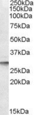 Western Blot: DPM1 Antibody [NBP1-05034]