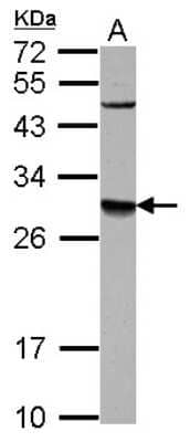 Western Blot: DPM1 Antibody [NBP2-16220]