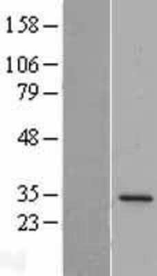 Western Blot: DPM1 Overexpression Lysate [NBL1-09992]