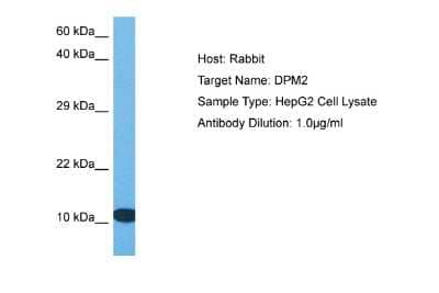 Western Blot: DPM2 Antibody [NBP2-84818]