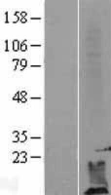 Western Blot: DPM2 Overexpression Lysate [NBL1-09993]