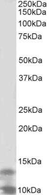 Western Blot: DPM3 Antibody [NBP2-26105]