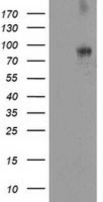 Western Blot: DPP10 Antibody (OTI1A5) [NBP2-01249]