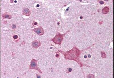 Immunohistochemistry-Paraffin: DPP10 Antibody [NB100-1511]
