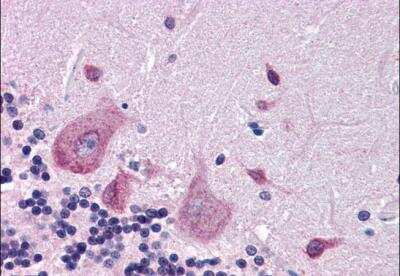 Immunohistochemistry-Paraffin: DPP10 Antibody [NB100-1511]