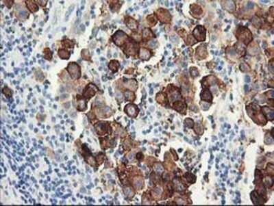 Immunohistochemistry: DPP10 Antibody (OTI1A5) - Azide and BSA Free [NBP2-72089]