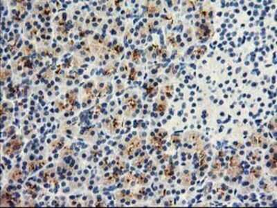 Immunohistochemistry: DPP10 Antibody (OTI1A5) - Azide and BSA Free [NBP2-72089]