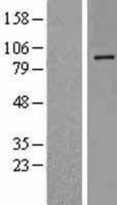 Western Blot: DPP10 Overexpression Lysate [NBL1-09994]