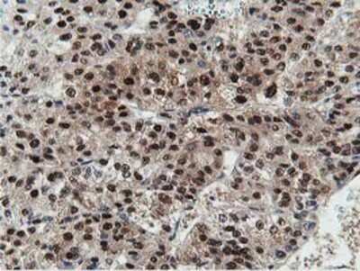 Immunohistochemistry-Paraffin: DPP3 Antibody (OTI2D9) [NBP2-01007]