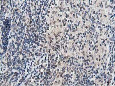 Immunohistochemistry-Paraffin: DPP3 Antibody (OTI2D9) [NBP2-01007]