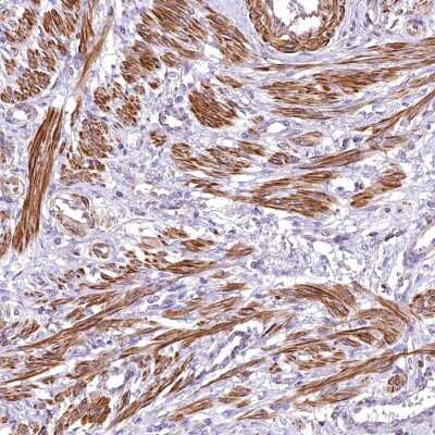 Immunohistochemistry-Paraffin: DPP3 Antibody [NBP2-34021]