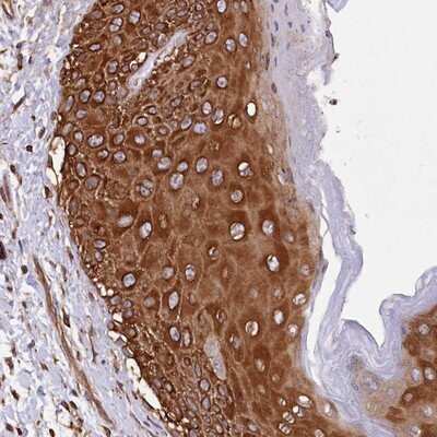 Immunohistochemistry-Paraffin: DPP3 Antibody [NBP1-89493]