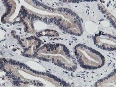 Immunohistochemistry: DPP3 Antibody (OTI2D9) - Azide and BSA Free [NBP2-71541]