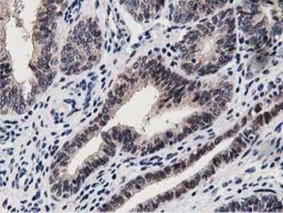 Immunohistochemistry: DPP3 Antibody (OTI2D9) - Azide and BSA Free [NBP2-71541]
