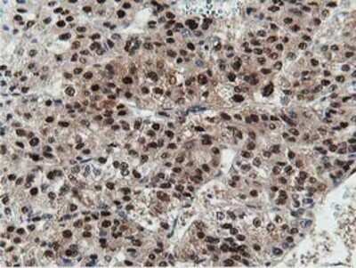 Immunohistochemistry: DPP3 Antibody (OTI2D9) - Azide and BSA Free [NBP2-71541]