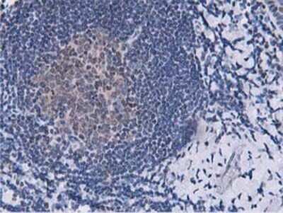 Immunohistochemistry: DPP3 Antibody (OTI2D9) - Azide and BSA Free [NBP2-71541]