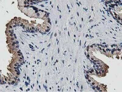 Immunohistochemistry: DPP3 Antibody (OTI2D9) - Azide and BSA Free [NBP2-71541]