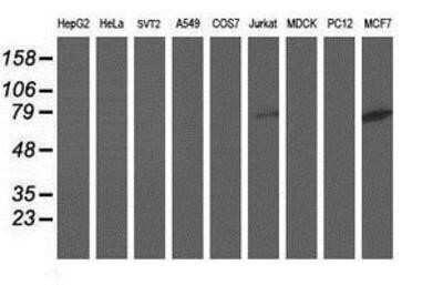 Western Blot: DPP3 Antibody (OTI2D9)Azide and BSA Free [NBP2-71541]