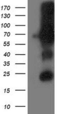 Western Blot: DPP3 Antibody (OTI2D9)Azide and BSA Free [NBP2-71541]