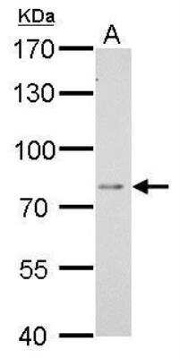 Western Blot: DPP3 Antibody [NBP1-31476]