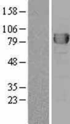 Western Blot: DPP3 Overexpression Lysate [NBL1-09996]