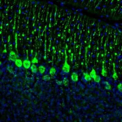 Immunohistochemistry: DPP6 Antibody [NBP2-47481]