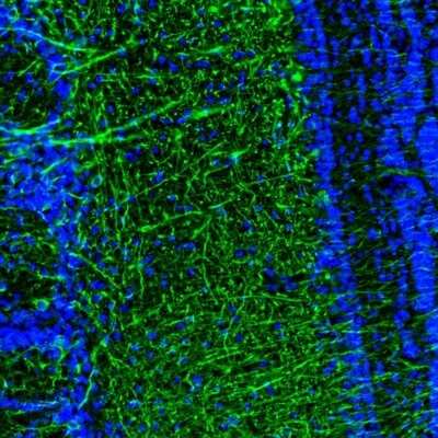 Immunohistochemistry: DPP6 Antibody [NBP2-47481]