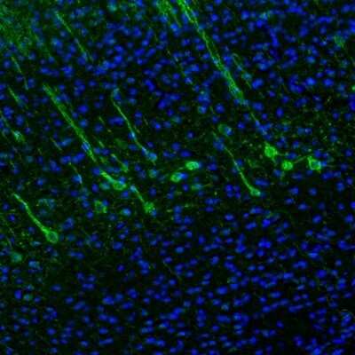 Immunohistochemistry: DPP6 Antibody [NBP2-47481]