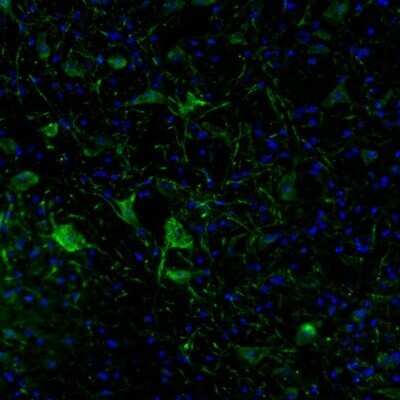 Immunohistochemistry: DPP6 Antibody [NBP2-47481]